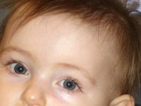 photos2011000113